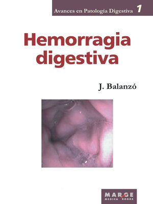 cover image of Hemorragia digestiva